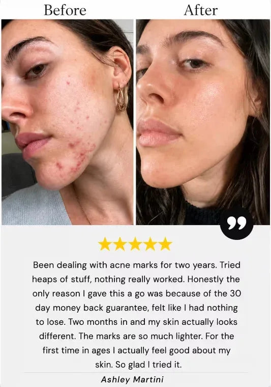 Customer result